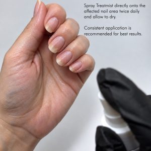 Treatmist 50 ml
